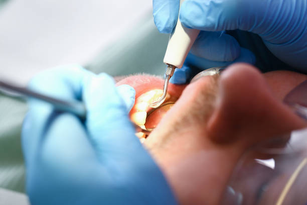 Best Emergency Root Canal Treatment in Woodland Hills, UT